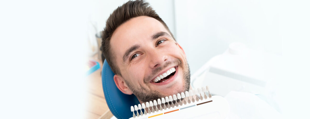 The time it takes to prep for veneers