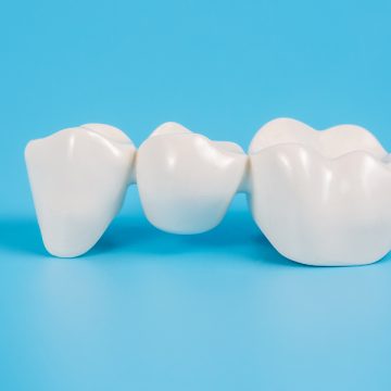 Is It Challenging to Eat with a Dental Bridge?