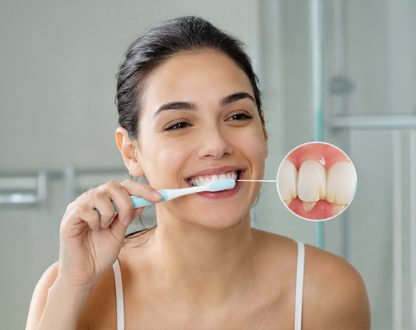 Yellow Plaque on Teeth: How to Remove It Before It Turns Into Gum Disease